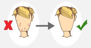 acne-cartoon-before-and-after