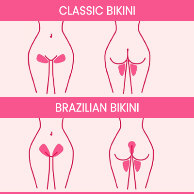 Difference Between Brazilian and Bikini Laser Hair Removal